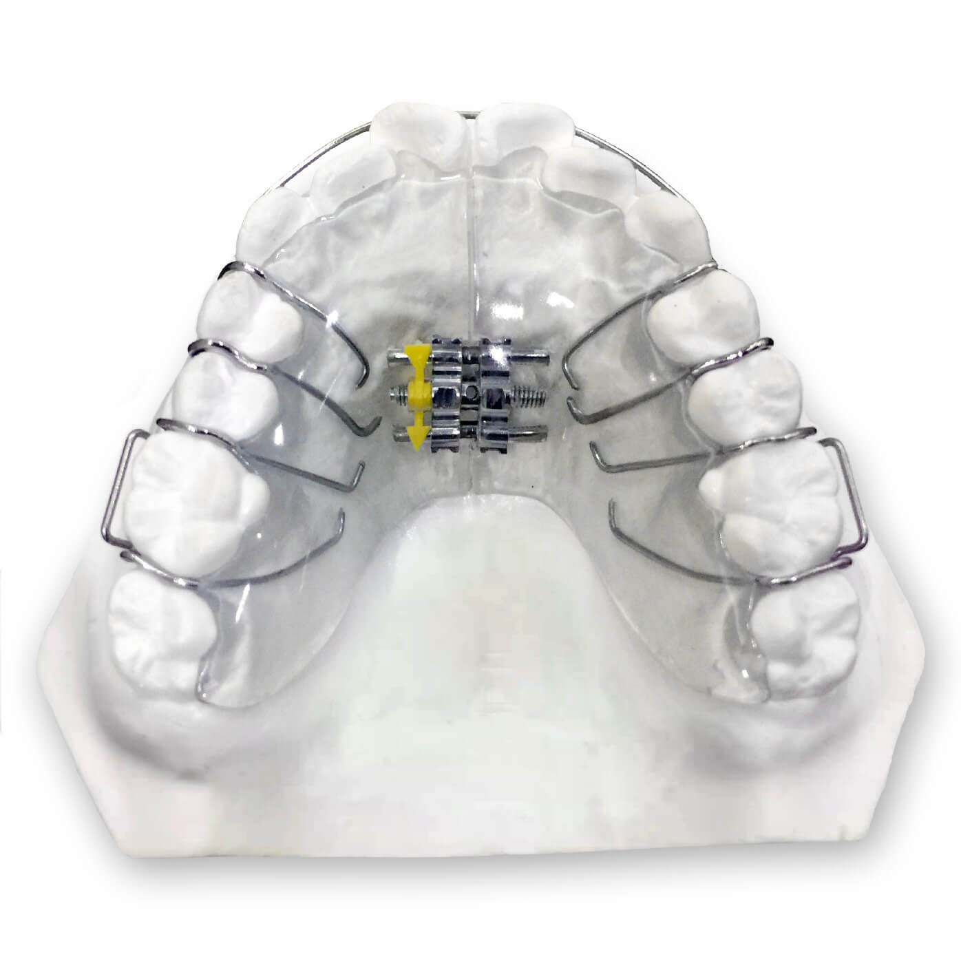 Lateral Growth Plate