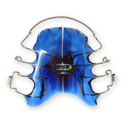 A blue acrylic dental appliance with metal wires and clasps designed for orthodontic purposes, likely to be used for creating space for permanent teeth or correcting dental crowding.
