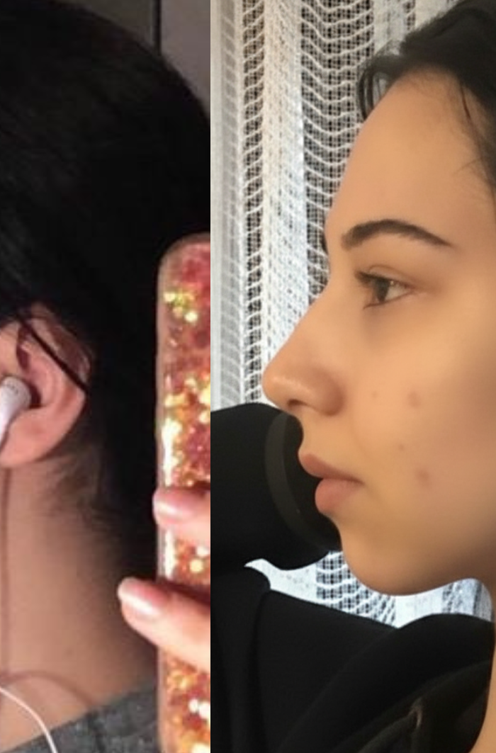 <h2><strong>The natural change</strong></h2>