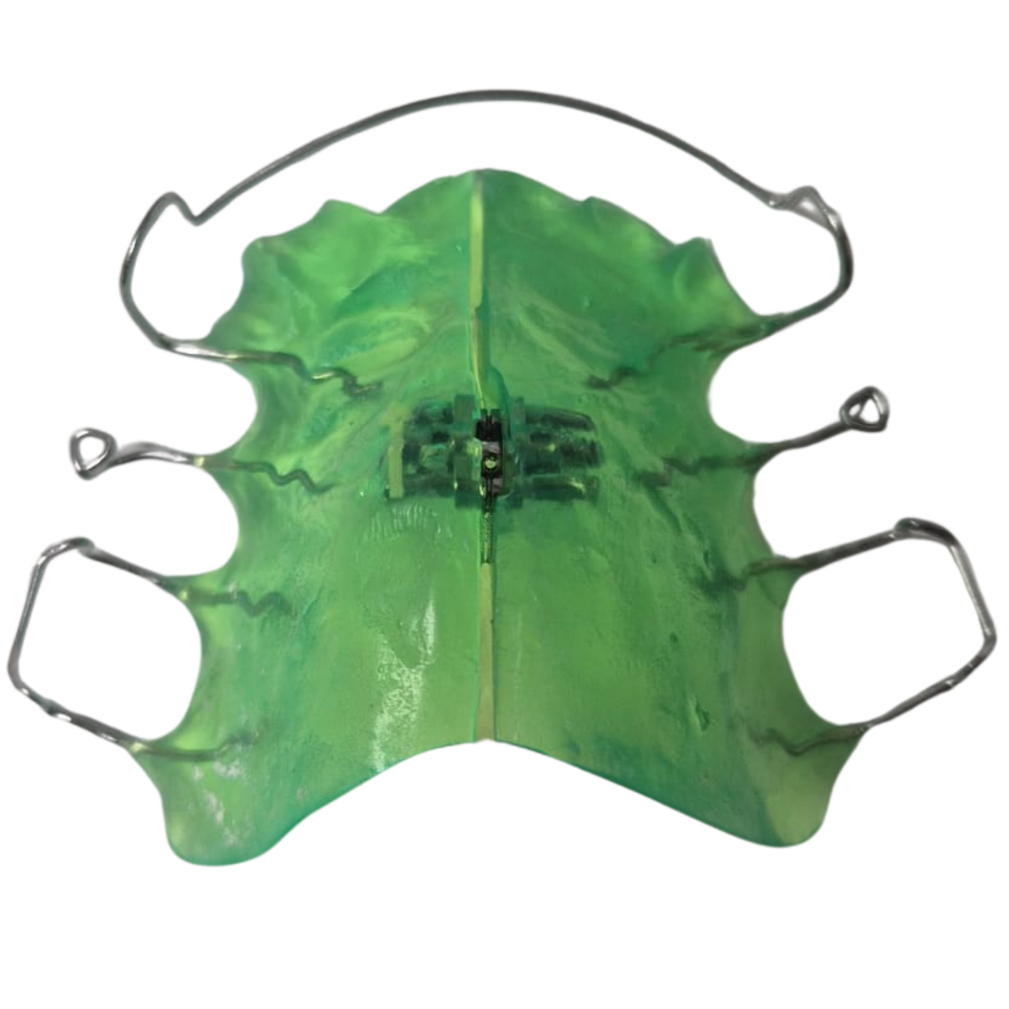 Lateral Growth Plate