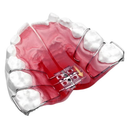 Lateral Growth Plate