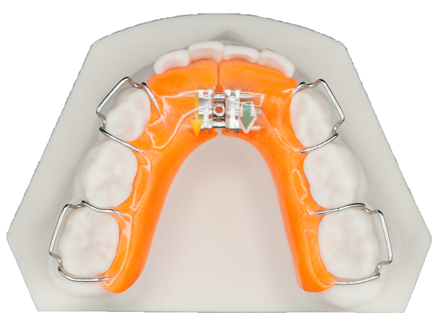 Lower Growth Plate