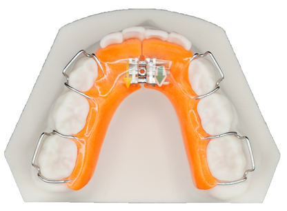 Lower Growth Plate