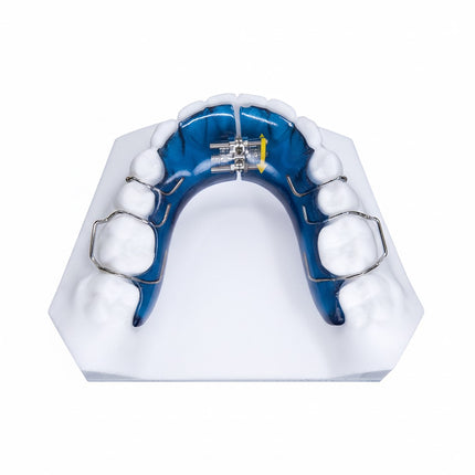 Dental retainer with blue plastic and metal components on a white background