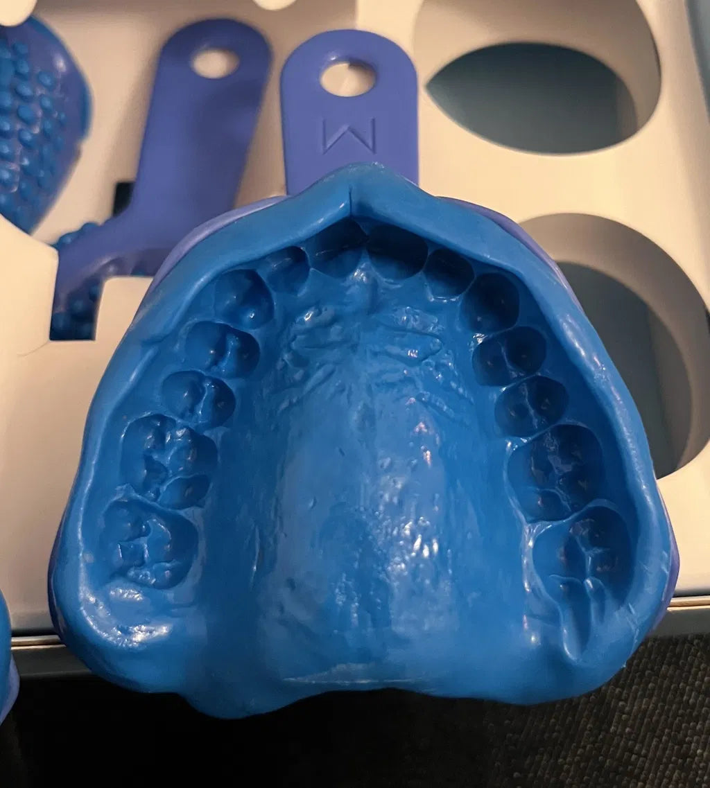 Blue dental impression close up