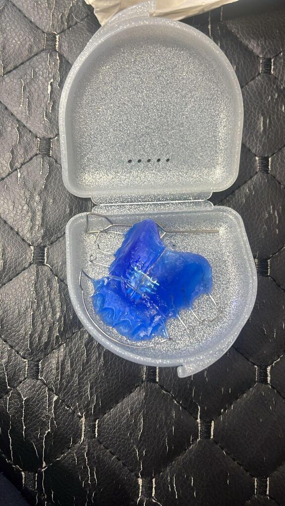 Blue appliance stored in a case