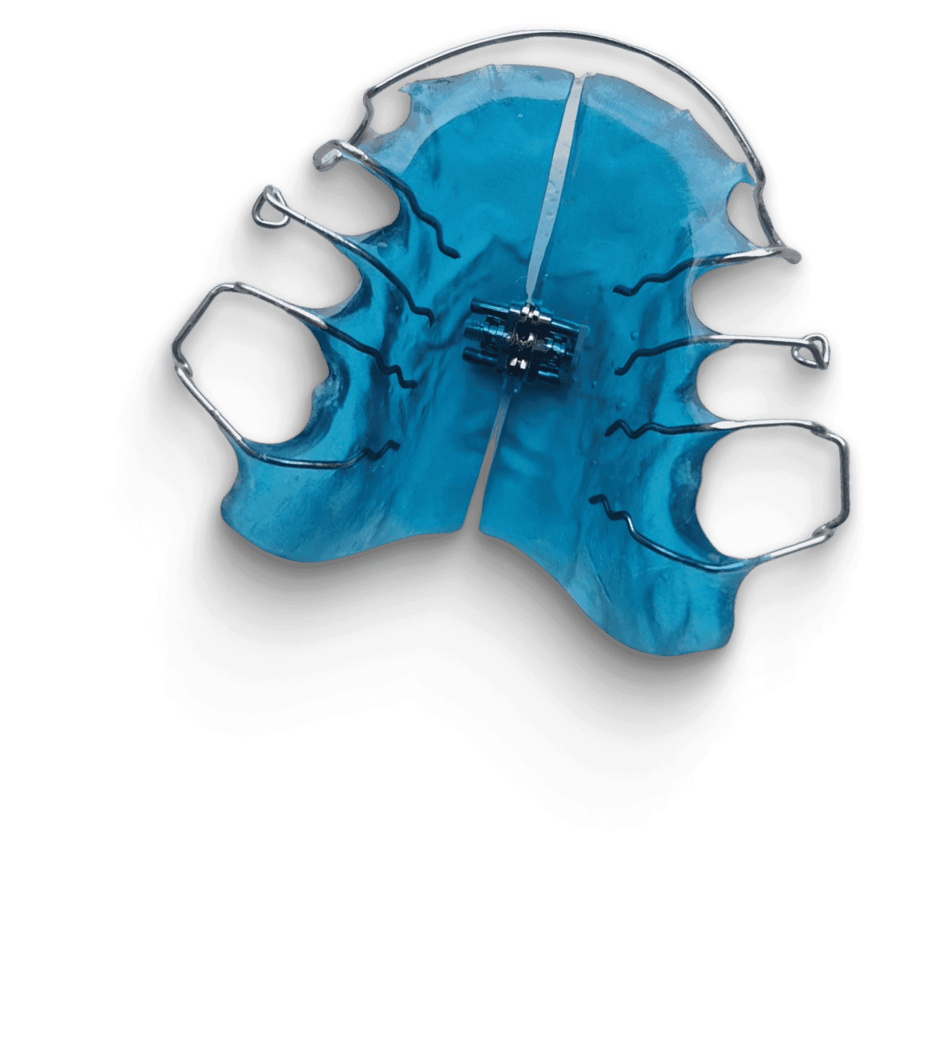 Mewingshop palatal expander plate